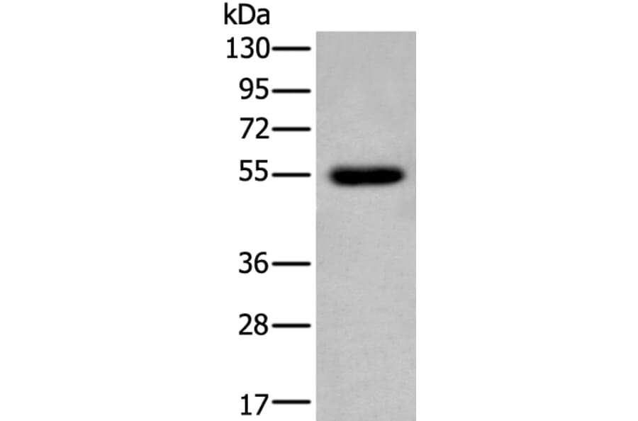 CDK14 Antibody from Signalway Antibody (43794) - Antibodies.com