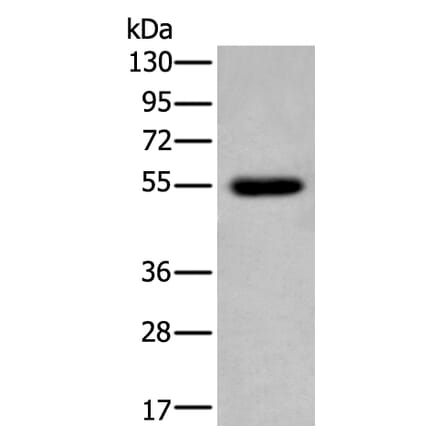 CDK14 Antibody from Signalway Antibody (43794) - Antibodies.com