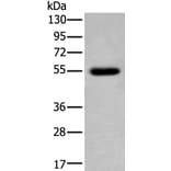 CDK14 Antibody from Signalway Antibody (43794) - Antibodies.com