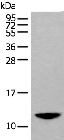 Gel: 12% SDS-PAGE Lysate: 40 &#956;g, Lane: A375 cell lysate, Primary antibody: BAGE2 antibody at dilution 1/200, Secondary antibody: Goat anti rabbit IgG at 1/8000 dilution, Exposure time: 90 seconds