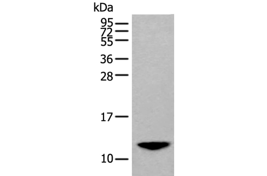 BAGE2 Antibody from Signalway Antibody (43843) - Antibodies.com
