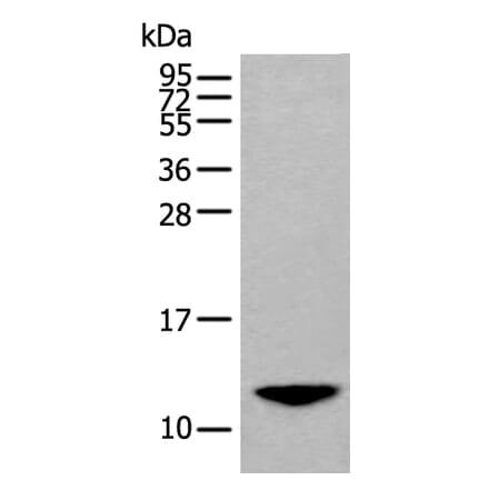 BAGE2 Antibody from Signalway Antibody (43843) - Antibodies.com