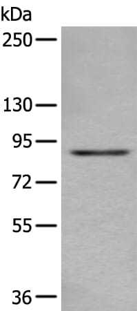 Gel: 6%SDS-PAGE Lysate: 40 &#956;g, Lane: A431 cell lysate, Primary antibody: DTX3L antibody at dilution 1/300, Secondary antibody: Goat anti rabbit IgG at 1/8000 dilution, Exposure time: 5 seconds