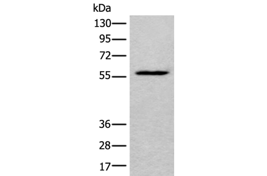 LDHD Antibody from Signalway Antibody (43877) - Antibodies.com