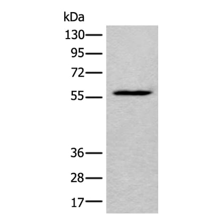 LDHD Antibody from Signalway Antibody (43877) - Antibodies.com