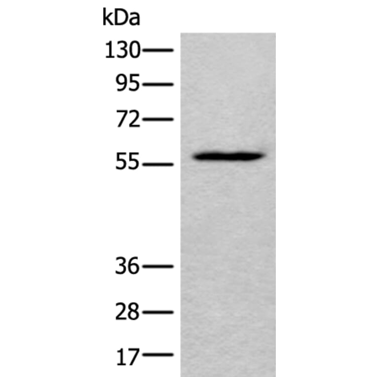 LDHD Antibody from Signalway Antibody (43877) - Antibodies.com