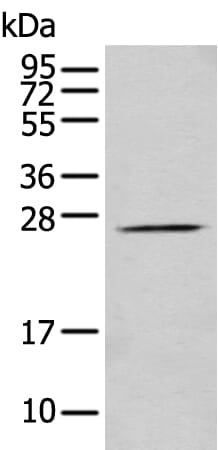 Gel: 12% SDS-PAGE Lysate: 40 &#956;g, Lane: Human fetal brain tissue , Primary antibody: PRRG3 antibody at dilution 1/200 dilution, Secondary antibody: Goat anti rabbit IgG at 1/8000 dilution, Exposure time: 1 minute