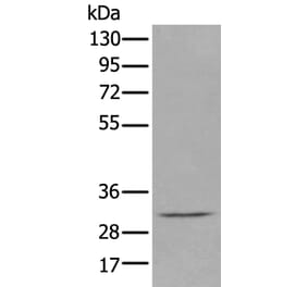 DECR2 Antibody from Signalway Antibody (43885) - Antibodies.com
