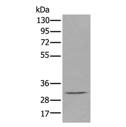 DECR2 Antibody from Signalway Antibody (43885) - Antibodies.com
