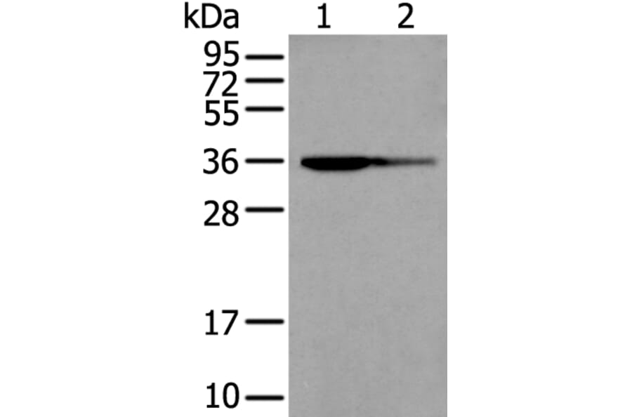 WARS2 Antibody from Signalway Antibody (43895) - Antibodies.com