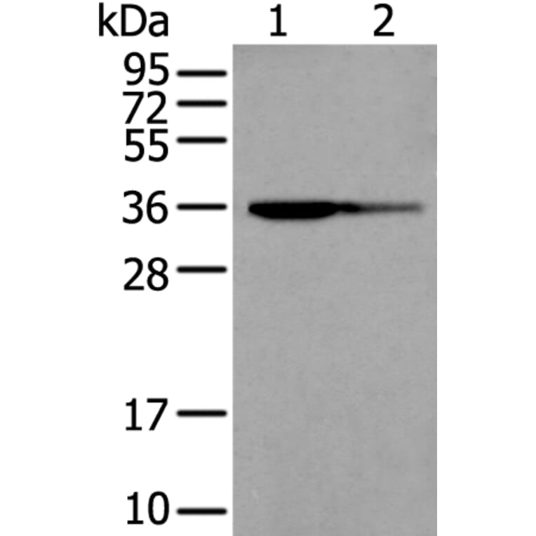 WARS2 Antibody from Signalway Antibody (43895) - Antibodies.com