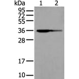 WARS2 Antibody from Signalway Antibody (43895) - Antibodies.com