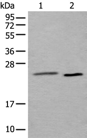 Gel: 12% SDS-PAGE Lysate: 40 &#956;g, Lane 1-2: Mouse testis tissue and Hela cell lysates, Primary antibody: UBE2T antibody at dilution 1/250, Secondary antibody: Goat anti rabbit IgG at 1/8000 dilution, Exposure time: 10 seconds