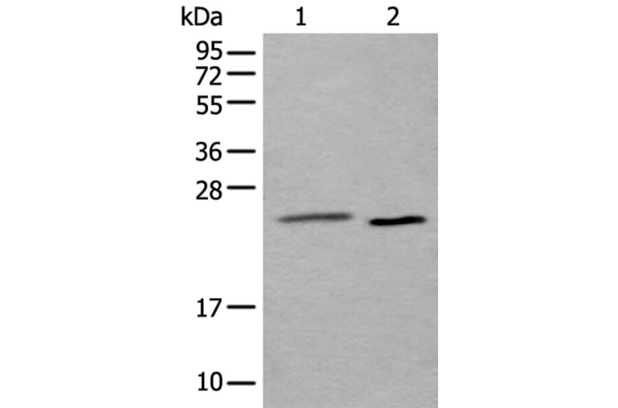 UBE2T Antibody from Signalway Antibody (43899) - Antibodies.com