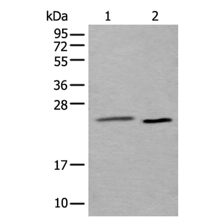 UBE2T Antibody from Signalway Antibody (43899) - Antibodies.com