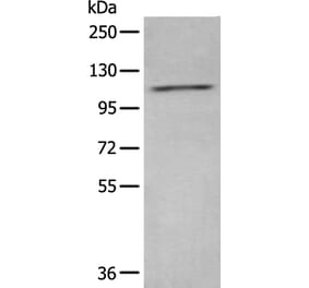 ADCY2 Antibody from Signalway Antibody (43960) - Antibodies.com