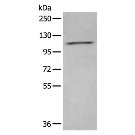 ADCY2 Antibody from Signalway Antibody (43960) - Antibodies.com