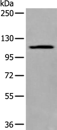 Gel: 6%SDS-PAGE Lysate: 40 &#956;g, Lane: A549 cell lysate, Primary antibody: XYLT1 antibody at dilution 1/300, Secondary antibody: Goat anti rabbit IgG at 1/8000 dilution, Exposure time: 1 minute