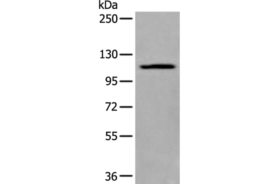 XYLT1 Antibody from Signalway Antibody (43975) - Antibodies.com