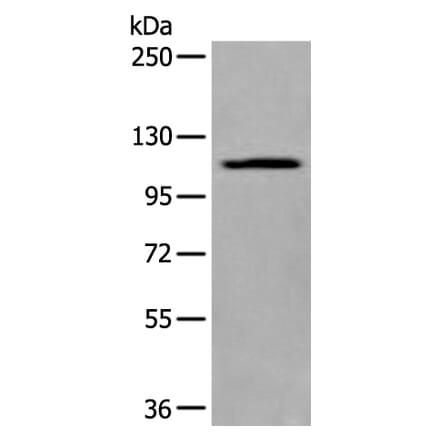 XYLT1 Antibody from Signalway Antibody (43975) - Antibodies.com