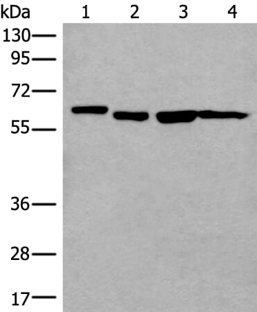 Gel: 8% SDS-PAGE Lysate: 40 &#956;g, Lane 1-4: 293T£¬Hela£¬Raji and A172 cell lysates, Primary antibody: UTP18 antibody at dilution 1/200, Secondary antibody: Goat anti rabbit IgG at 1/8000 dilution, Exposure time: 1 minute