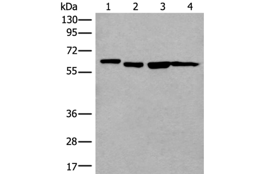 UTP18 Antibody from Signalway Antibody (43990) - Antibodies.com
