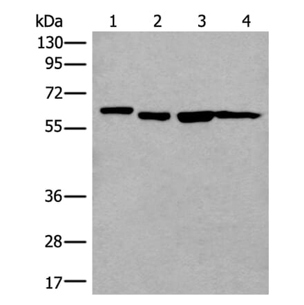 UTP18 Antibody from Signalway Antibody (43990) - Antibodies.com