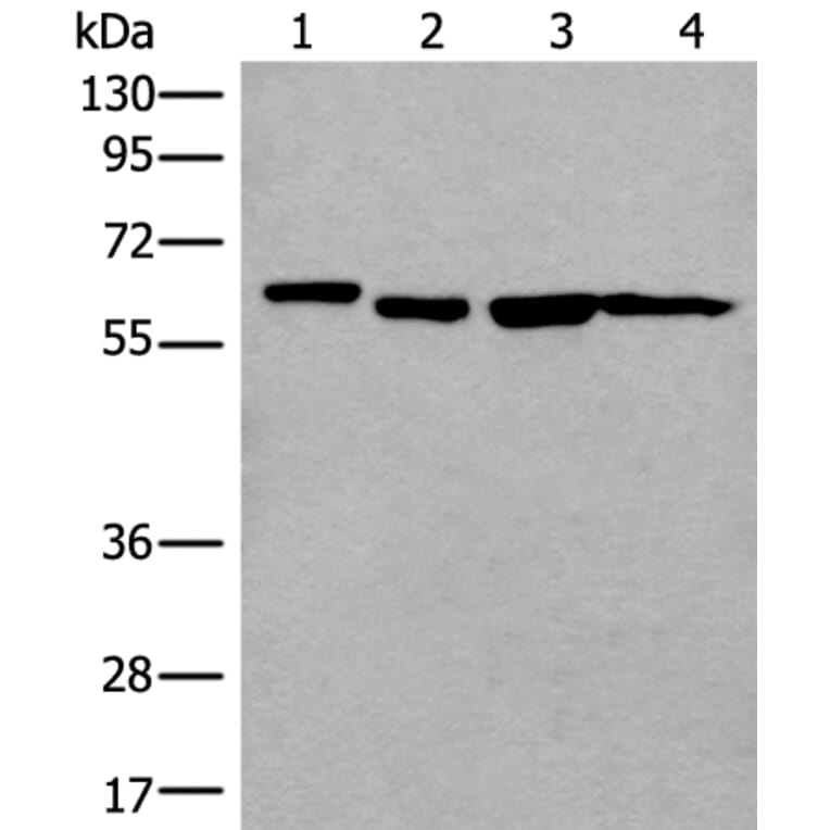 UTP18 Antibody from Signalway Antibody (43990) - Antibodies.com