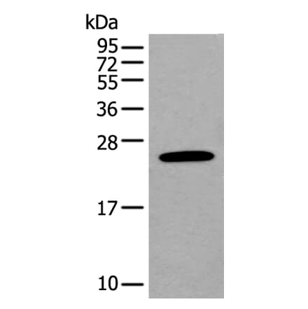 BASP1 Antibody from Signalway Antibody (43991) - Antibodies.com