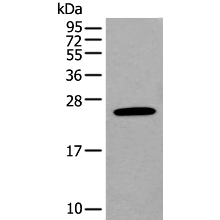 BASP1 Antibody from Signalway Antibody (43991) - Antibodies.com