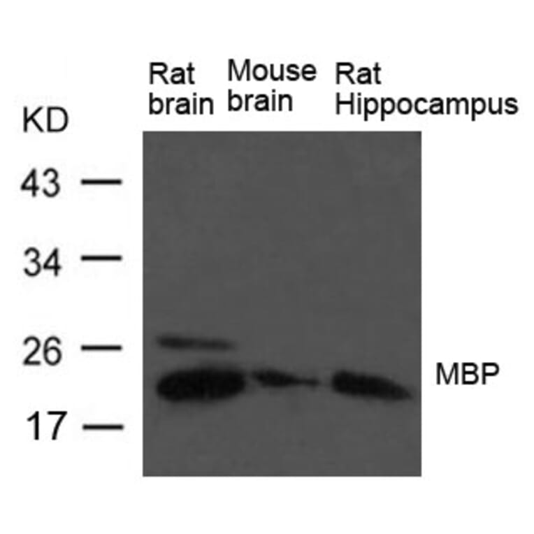 Western blot - MBP (myelin basic protein) Antibody from Signalway Antibody (21640) - Antibodies.com