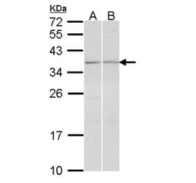 TGF beta induced factor 2 antibody from Signalway Antibody (22431) - Antibodies.com