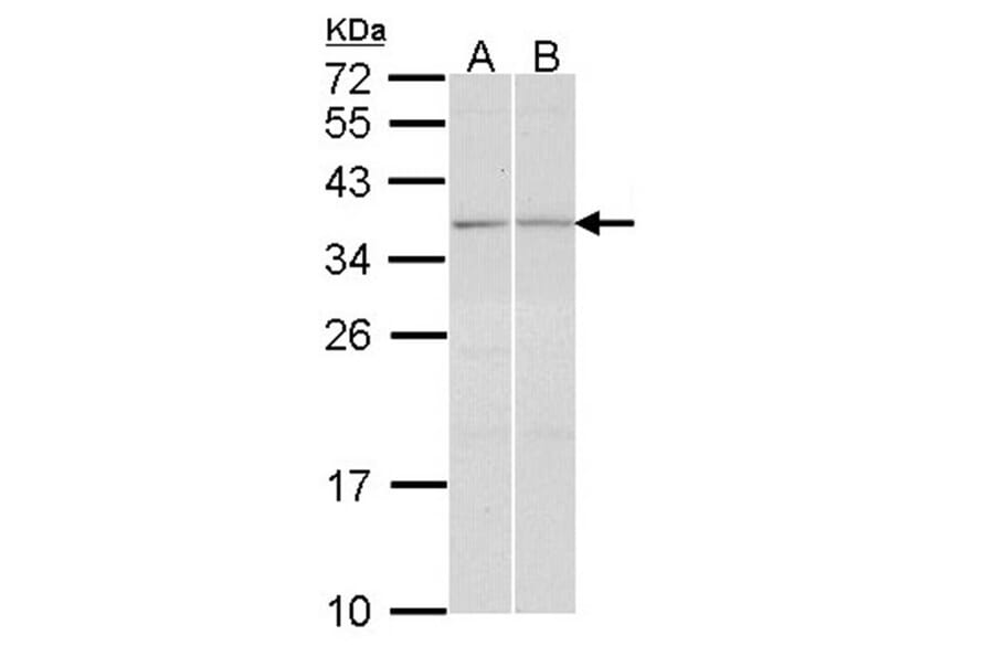 TGF beta induced factor 2 antibody from Signalway Antibody (22431) - Antibodies.com