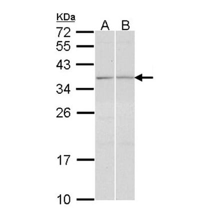 TGF beta induced factor 2 antibody from Signalway Antibody (22431) - Antibodies.com