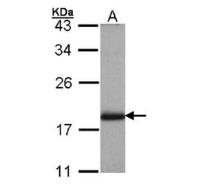 ADP-ribosylation factor 3 antibody from Signalway Antibody (22966) - Antibodies.com