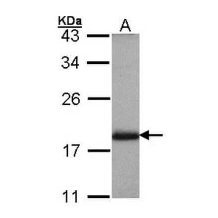 ADP-ribosylation factor 3 antibody from Signalway Antibody (22966) - Antibodies.com