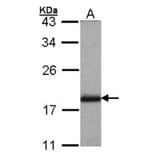 ADP-ribosylation factor 3 antibody from Signalway Antibody (22966) - Antibodies.com