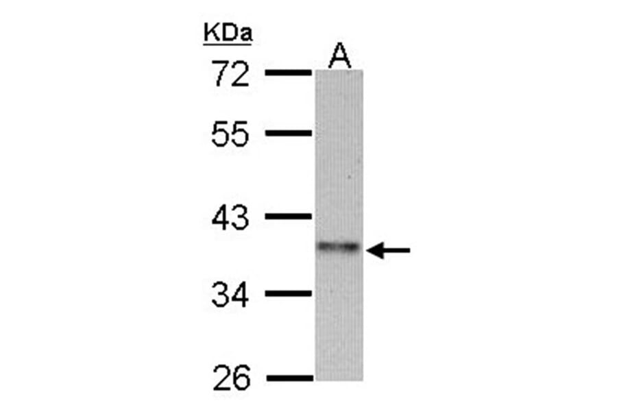 cyclin I family, member 2 antibody from Signalway Antibody (23185) - Antibodies.com