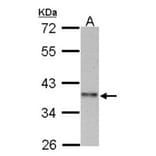 cyclin I family, member 2 antibody from Signalway Antibody (23185) - Antibodies.com