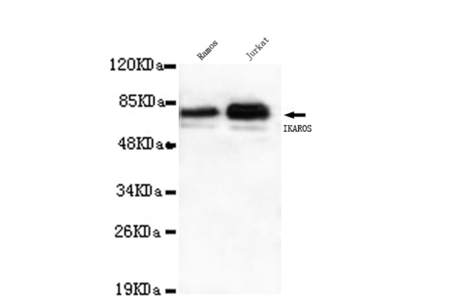 Ikaros (C-term) Monoclonal Antibody from Signalway Antibody (27062) - Antibodies.com