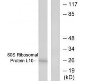 Western blot - 60S Ribosomal Protein L10 Antibody from Signalway Antibody (33542) - Antibodies.com