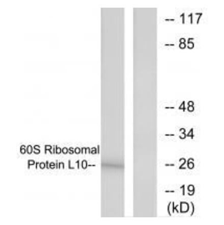 Western blot - 60S Ribosomal Protein L10 Antibody from Signalway Antibody (33542) - Antibodies.com
