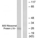 Western blot - 60S Ribosomal Protein L10 Antibody from Signalway Antibody (33542) - Antibodies.com