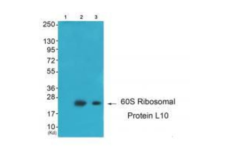 Western blot - 60S Ribosomal Protein L10 Antibody from Signalway Antibody (33542) - Antibodies.com