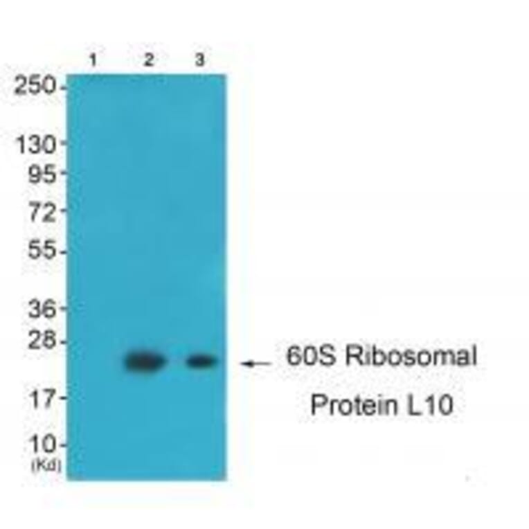 Western blot - 60S Ribosomal Protein L10 Antibody from Signalway Antibody (33542) - Antibodies.com