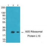 Western blot - 60S Ribosomal Protein L10 Antibody from Signalway Antibody (33542) - Antibodies.com