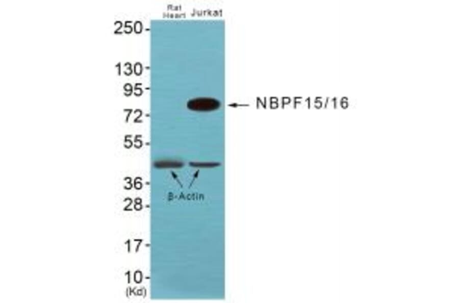Western blot - NBPF1/9/10/12/14/15/16/20 Antibody from Signalway Antibody (34853) - Antibodies.com