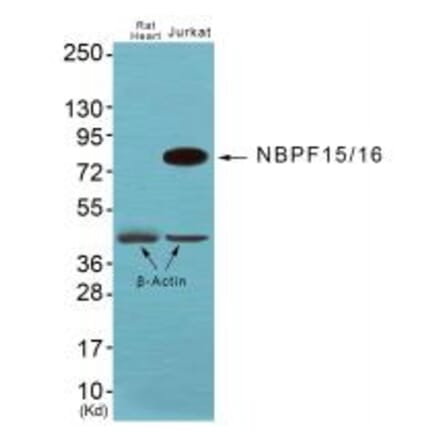 Western blot - NBPF1/9/10/12/14/15/16/20 Antibody from Signalway Antibody (34853) - Antibodies.com