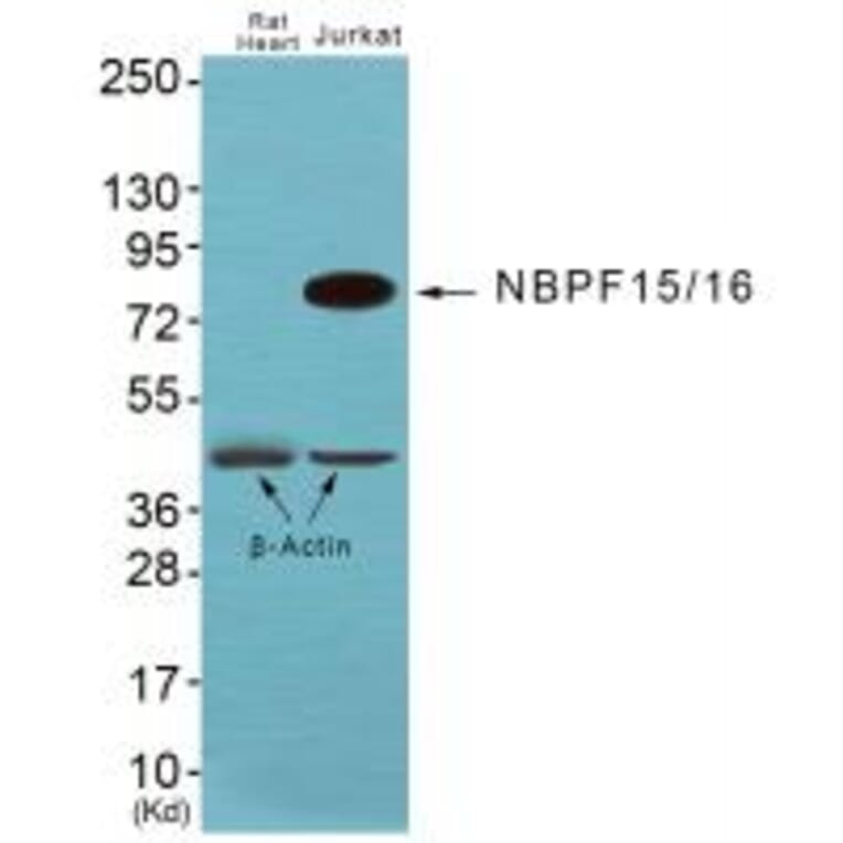 Western blot - NBPF1/9/10/12/14/15/16/20 Antibody from Signalway Antibody (34853) - Antibodies.com
