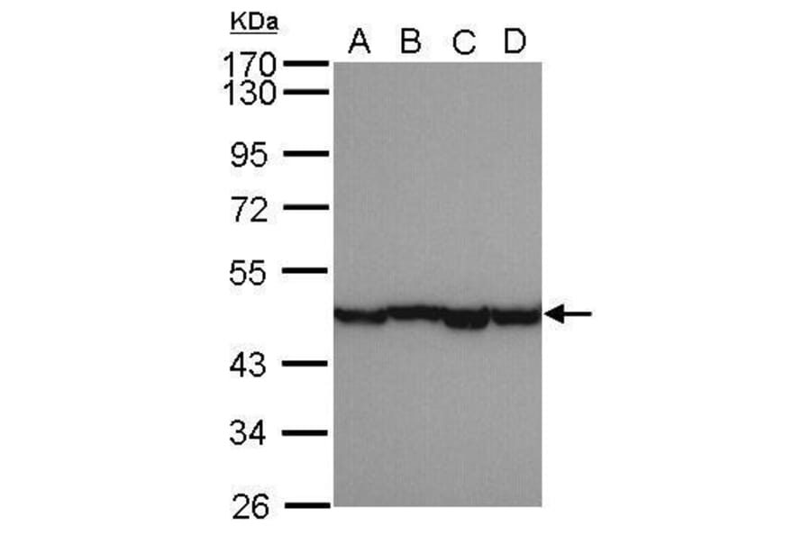 alpha smooth muscle Actin Antibody from Signalway Antibody (35513) - Antibodies.com
